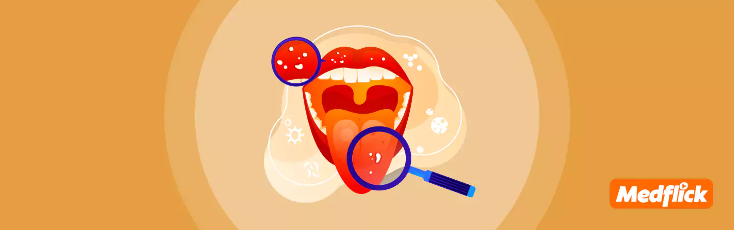 All You Need to Know About Mouth Cancer Symptoms, Causes, & Risk Factors